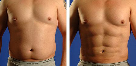 Poliklinika Milojević