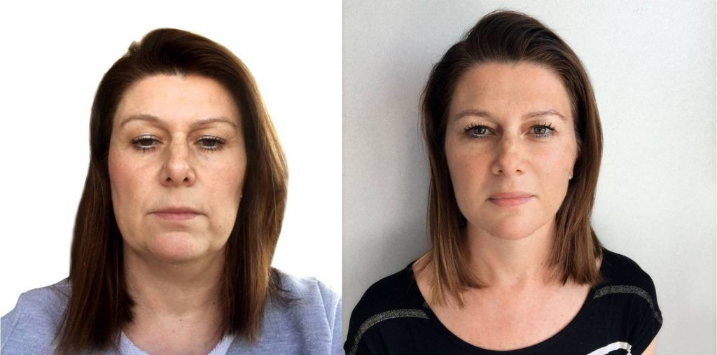 Prije i poslije makeovera