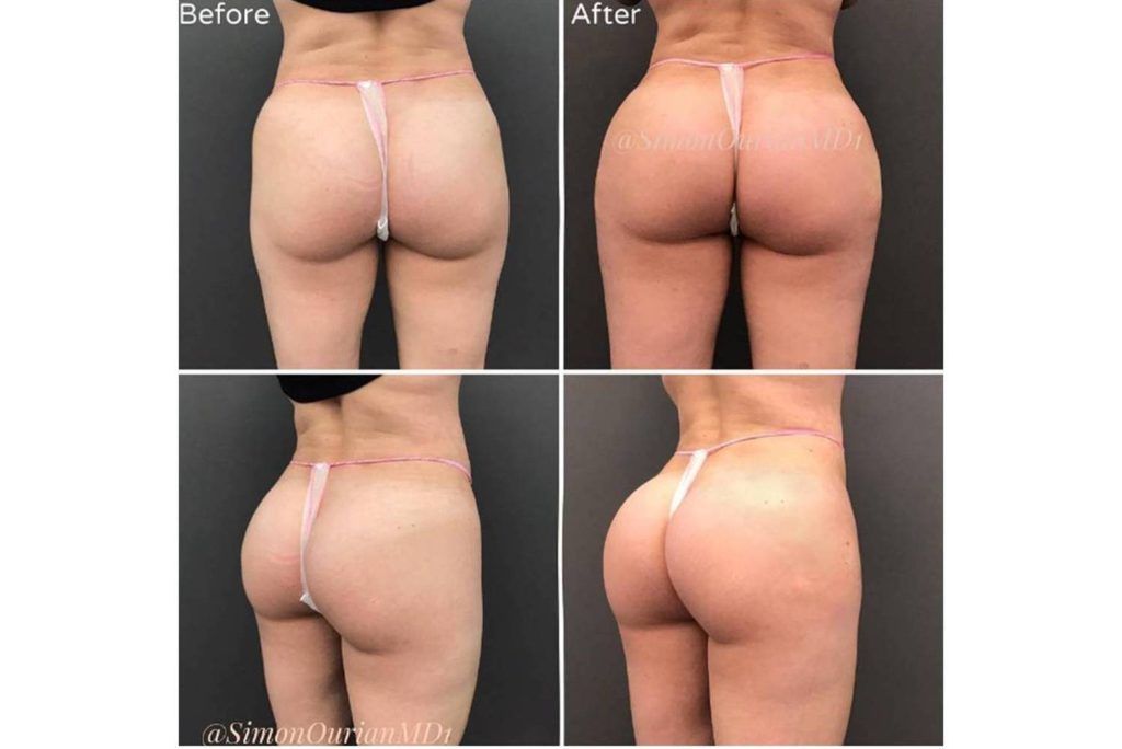 Iz arhive dr. Simona Ouriana. Izvor: Instagram