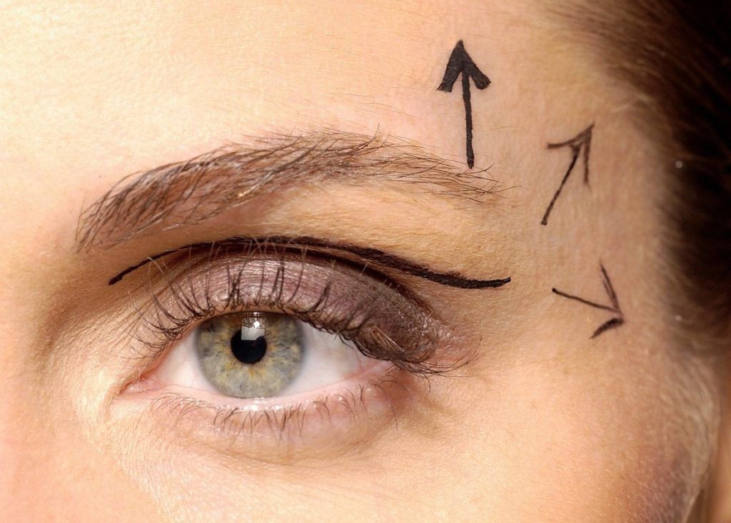 Woman preparing for cosmetic surgery, Image: 2853676, License: Royalty-free, Restrictions: Specifically, you may not use the Images in ways or contexts that might reasonably be construed as pornographic, defamatory, libellous or otherwise unlawful; Specifically, you may not use images depicting any model in any unduly controversial or unflattering context, unless accompanied with a statement indicating that the person is a model and the images are being used for illustrative purposes only., Model Release: yes, Credit line: Profimedia, ImageSource