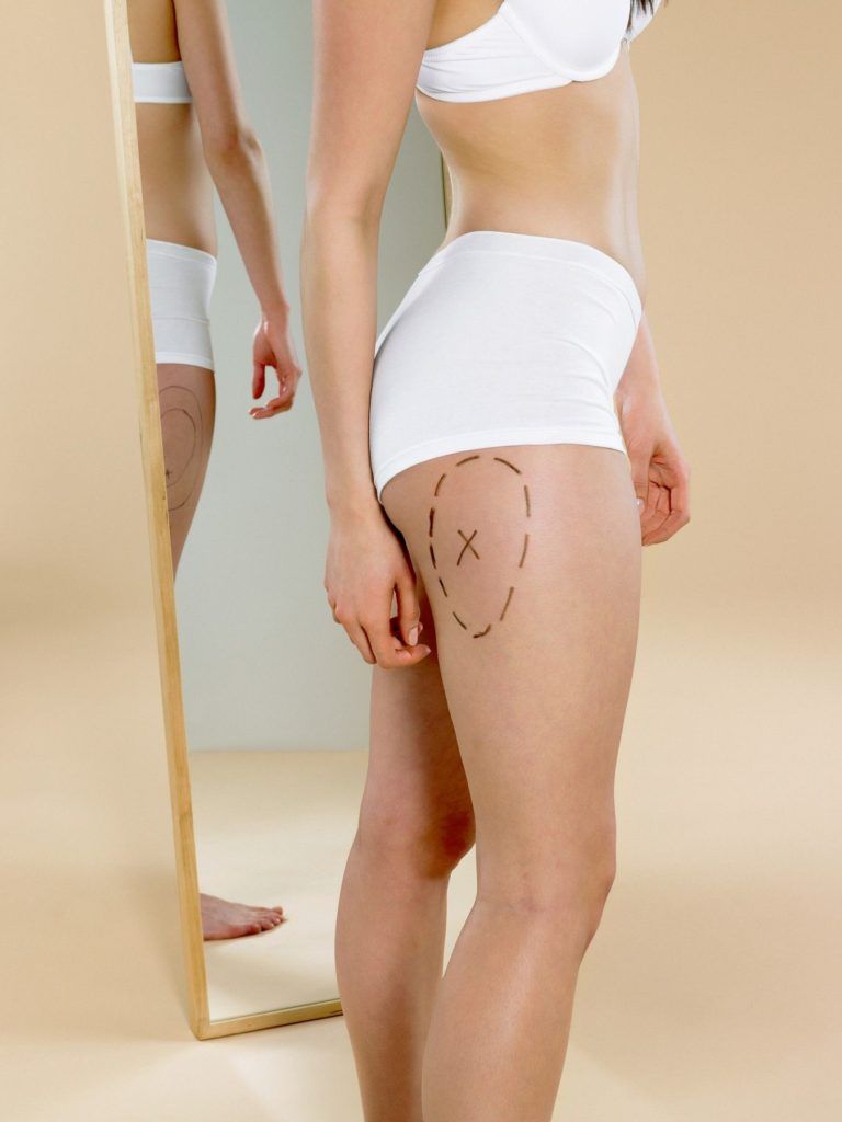 Woman with mark on her leg