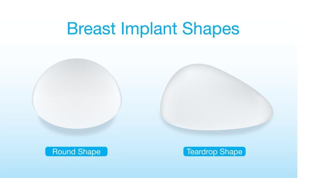Difference of breast implant round and teardrop shapes. This illustration about cosmetic surgery., Image: 312364373, License: Royalty-free, Restrictions: , Model Release: no, Credit line: Profimedia, Alamy