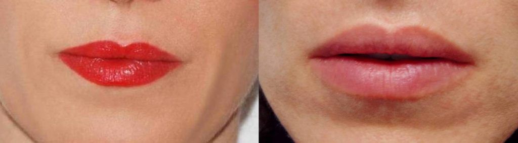 Prije i poslije (iz arhive dr. Miletića)