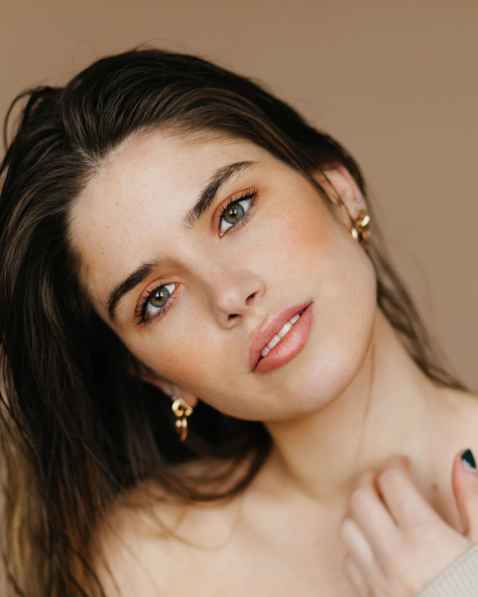 Ne dirajte – kaže koža: evo zašto nastaju mrlje od prištića i kako ih izbjeći