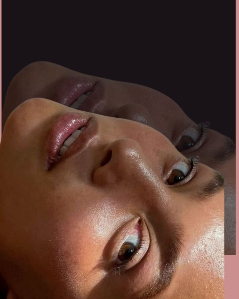 Koža bez mrlja: Hiperpigmentacije i što zaista na njih djeluje