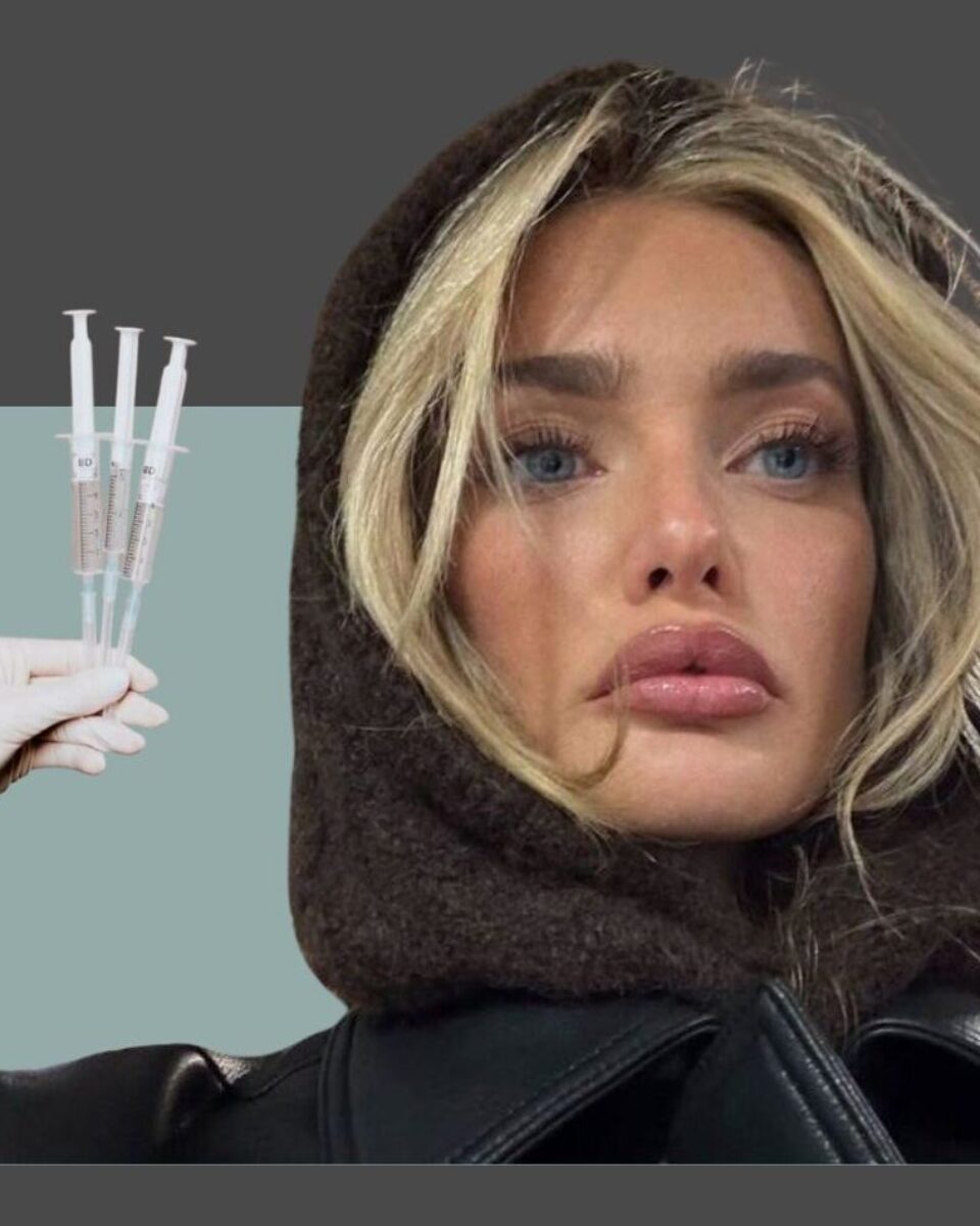 Pitali smo dr. Jakova Jurčevića pada li filerima popularnost?