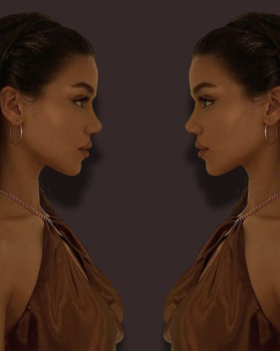 Prof. Gjurić: kirurg koji dokazuje da svaki nos može biti savršen. Donosimo sjajne primjere ‘prije’ i ‘poslije’