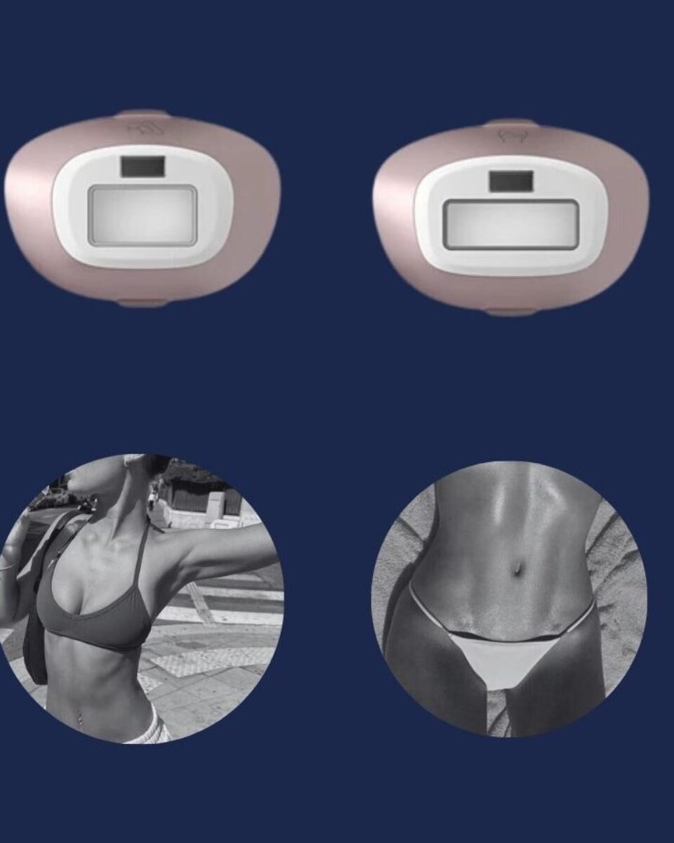 IPL kod kuće ili u salonu? Otkrivamo zašto žene biraju praktičniju opciju