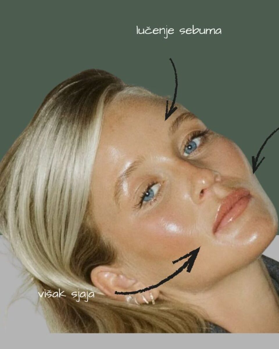 Što uzrokuje proširene pore i kako ih učiniti manje vidljivima?