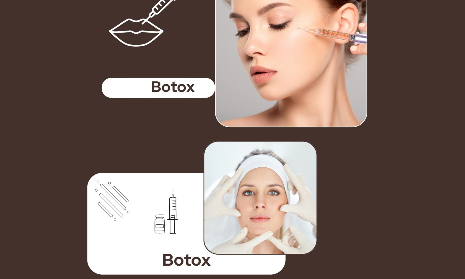 Što sve botox može napraviti za vaše lice