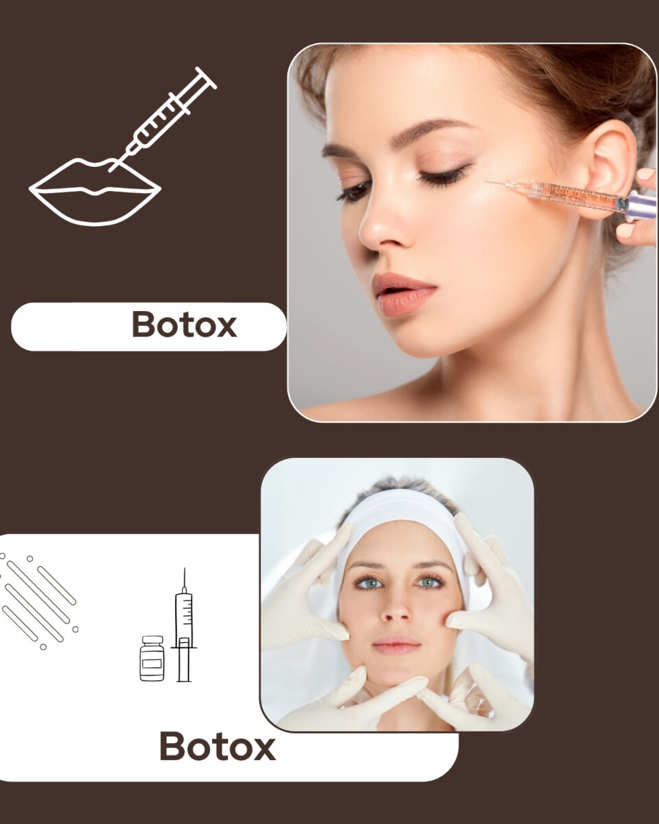 Što sve botox može napraviti za vaše lice