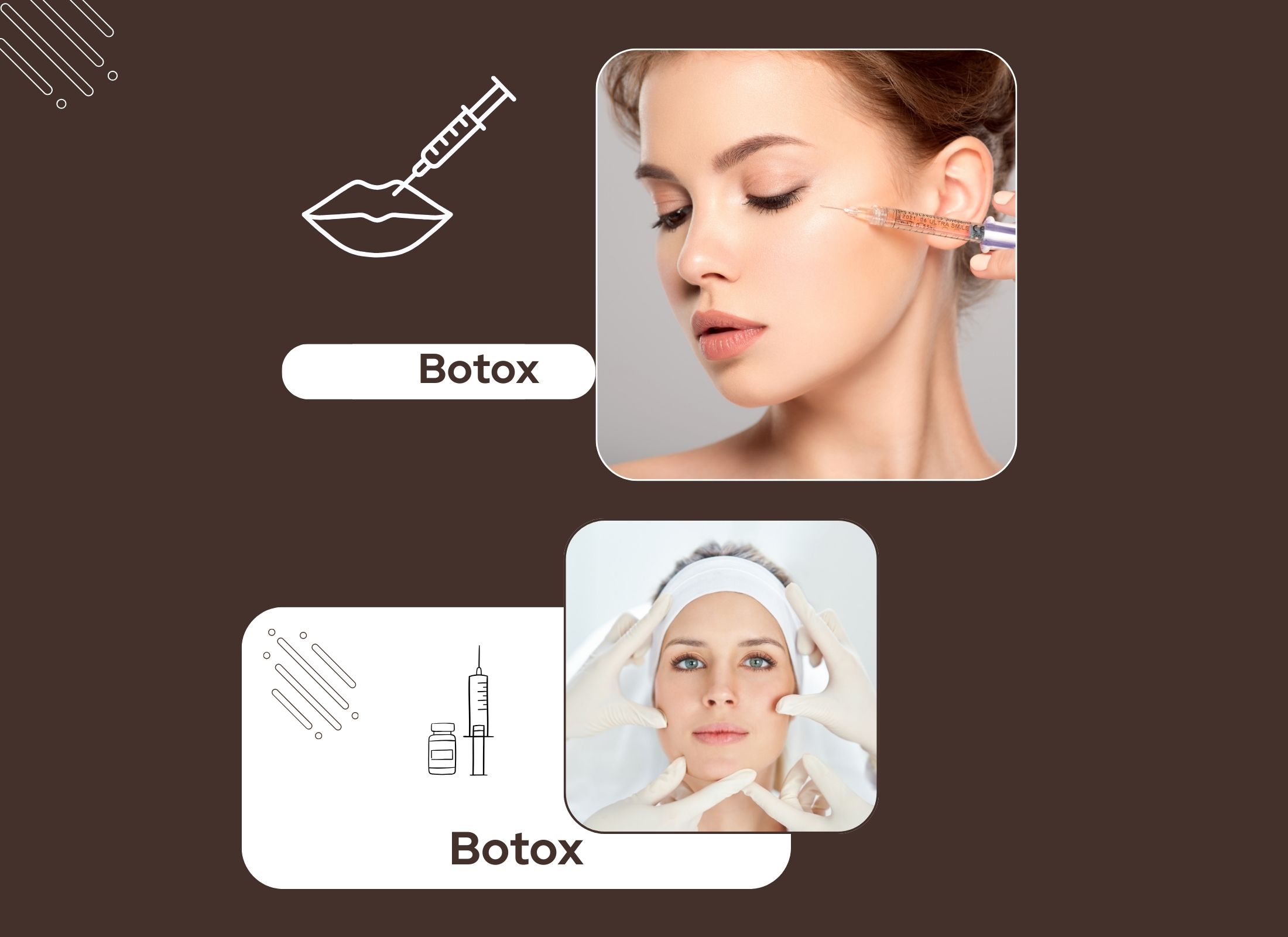 Što sve botox može napraviti za vaše lice