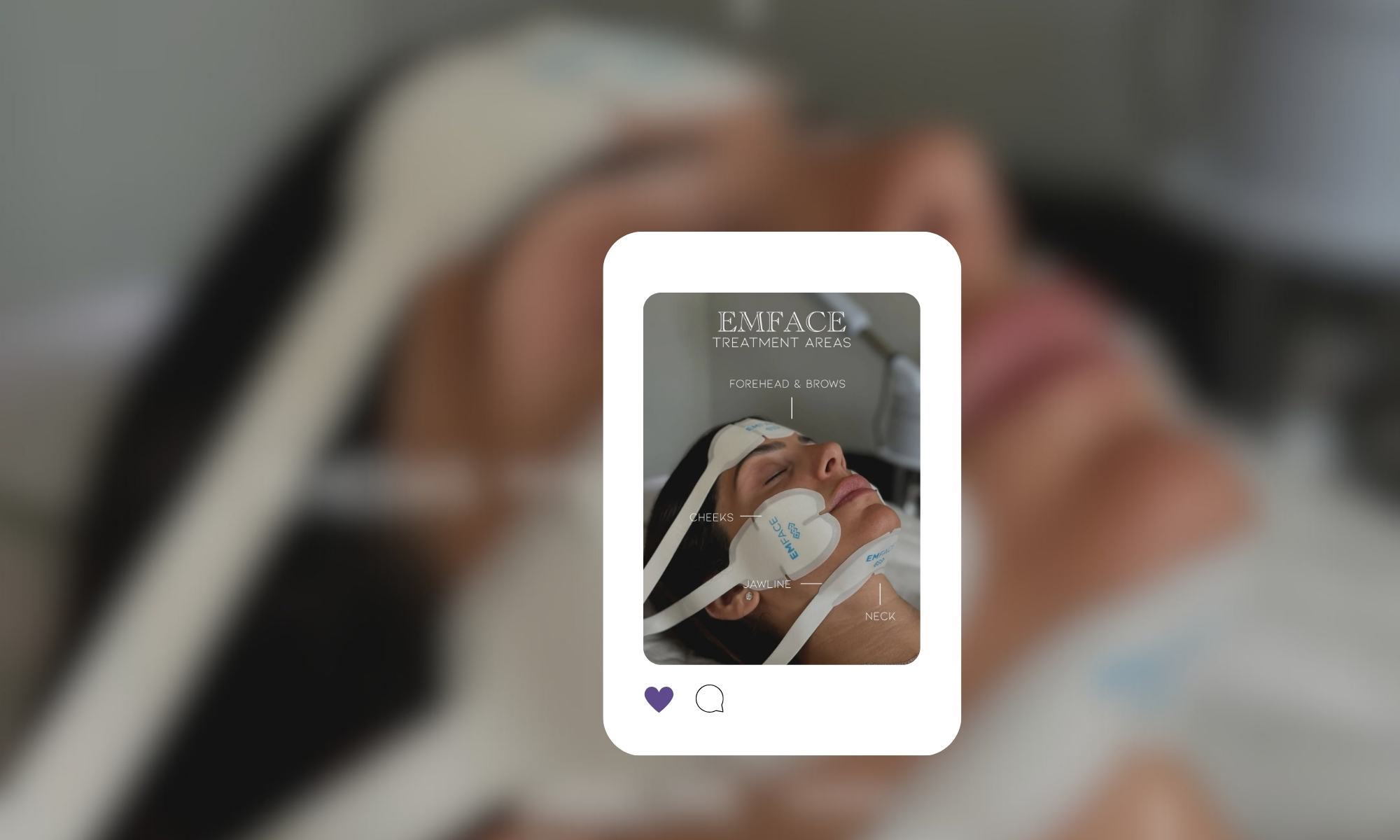 BTL uspješno zaštitio patentna prava EMFACE® tehnologije protiv uređaja WonderFace