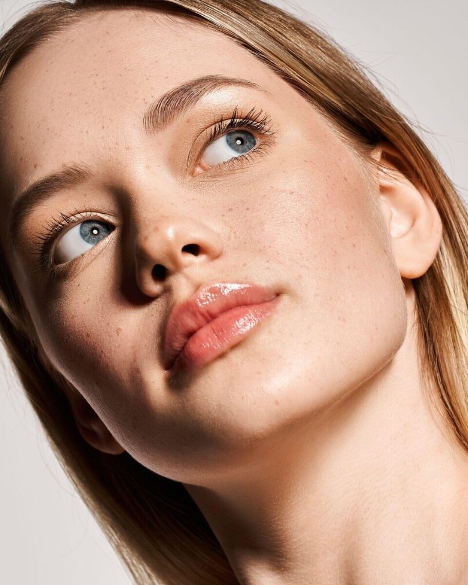 Sve što trebate znati o papulopustuloznim aknama: od uzroka do liječenja