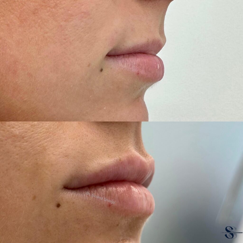 dr. suzana smoljo fileri