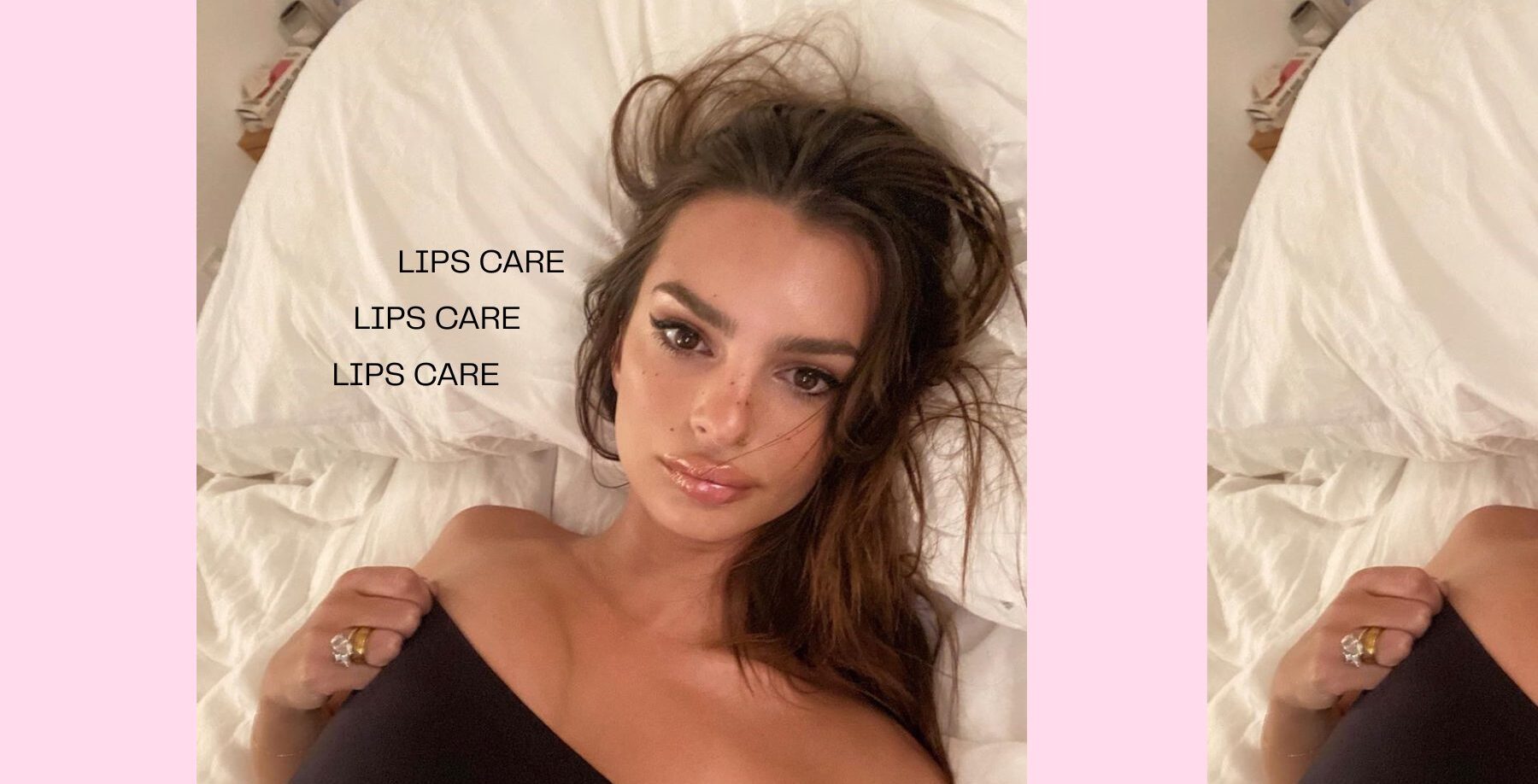 Kako njegovati usne nakon filera i ubrzati oporavak?