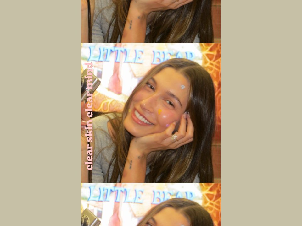 Spriječite nepravilnosti na vrijeme: izdvajamo sastojke koji djeluju na akne i prištiće