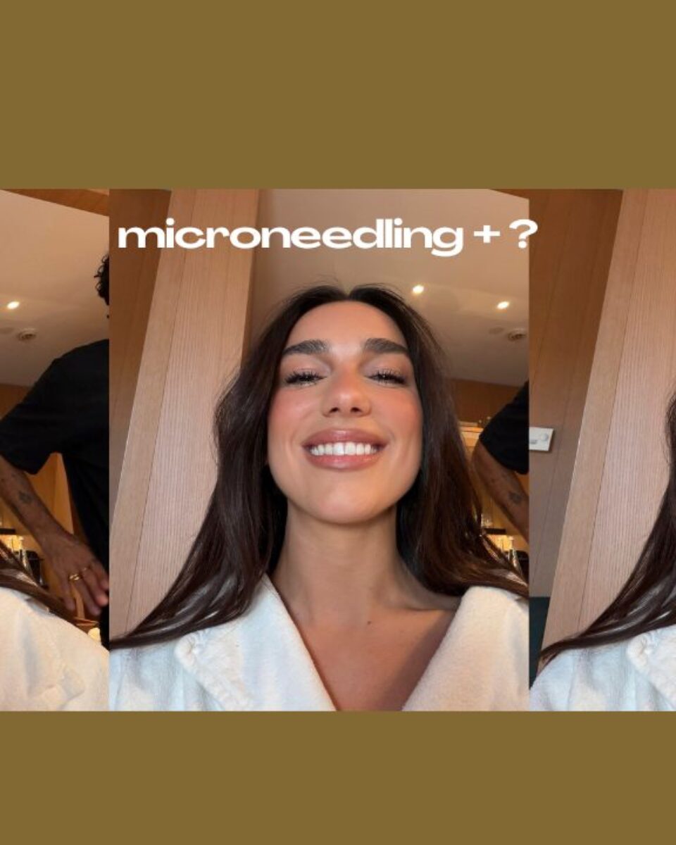 Top tretmani koje možete kombinirati s microneedlingom za maksimalne rezultate