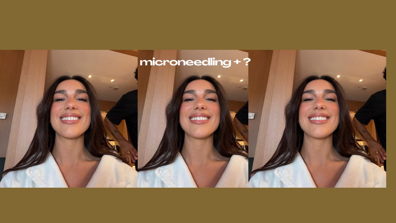 Top tretmani koje možete kombinirati s microneedlingom za maksimalne rezultate