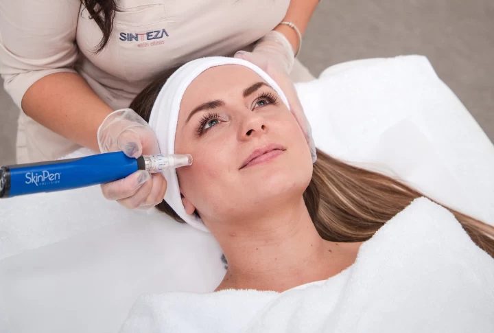 SkinPen Terapija mikroiglicama u Poliklinici Sinteza