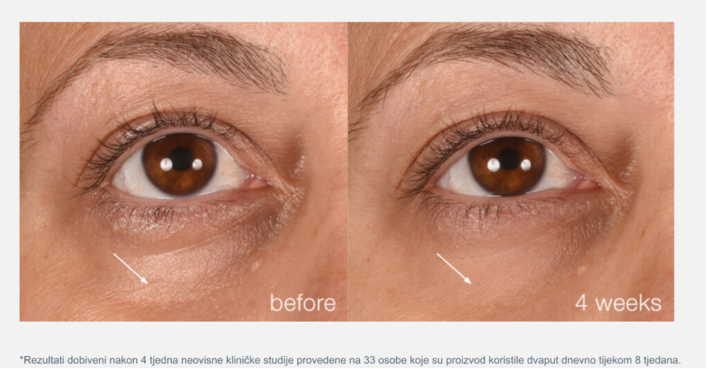 Rezultati prije, nakon četiri i nakon osam tjedana korištenja Dermalogica Smart Eye Density seruma
