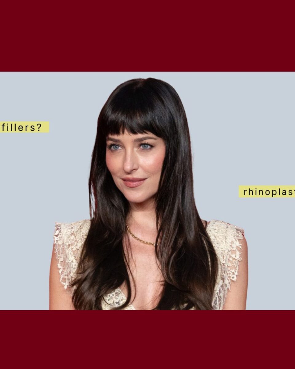 Zašto Dakota Johnson izgleda bolje nego ikad? Pitali smo kirurga koji bi tretmani mogli biti zaslužni